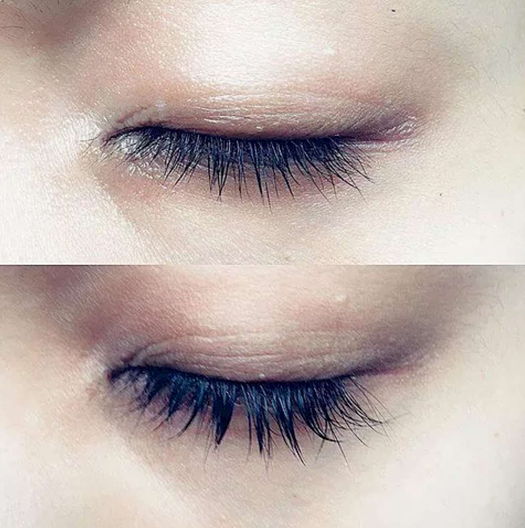 lilash before and after